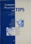Current Practice of TIPS